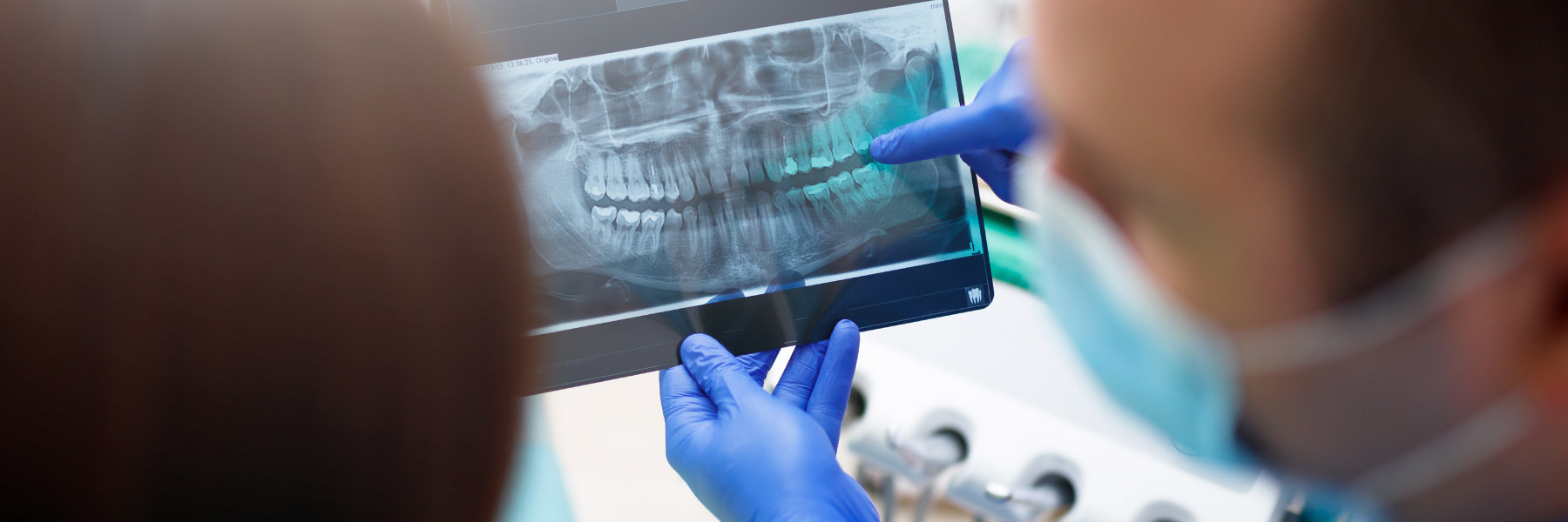 A dentistry professional points at an x-ray of teeth.